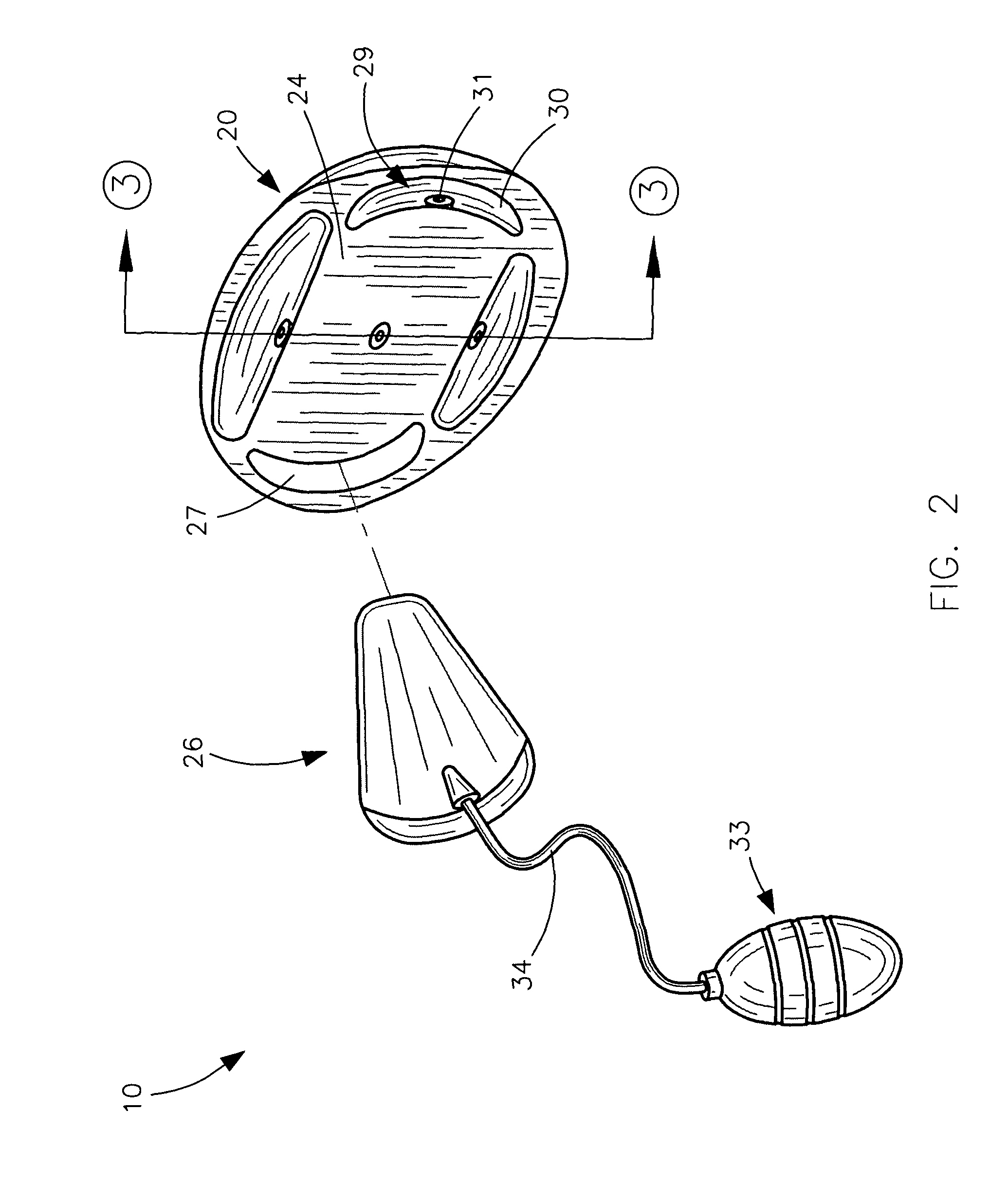 Inflatable prosthetic breast assembly and associated method