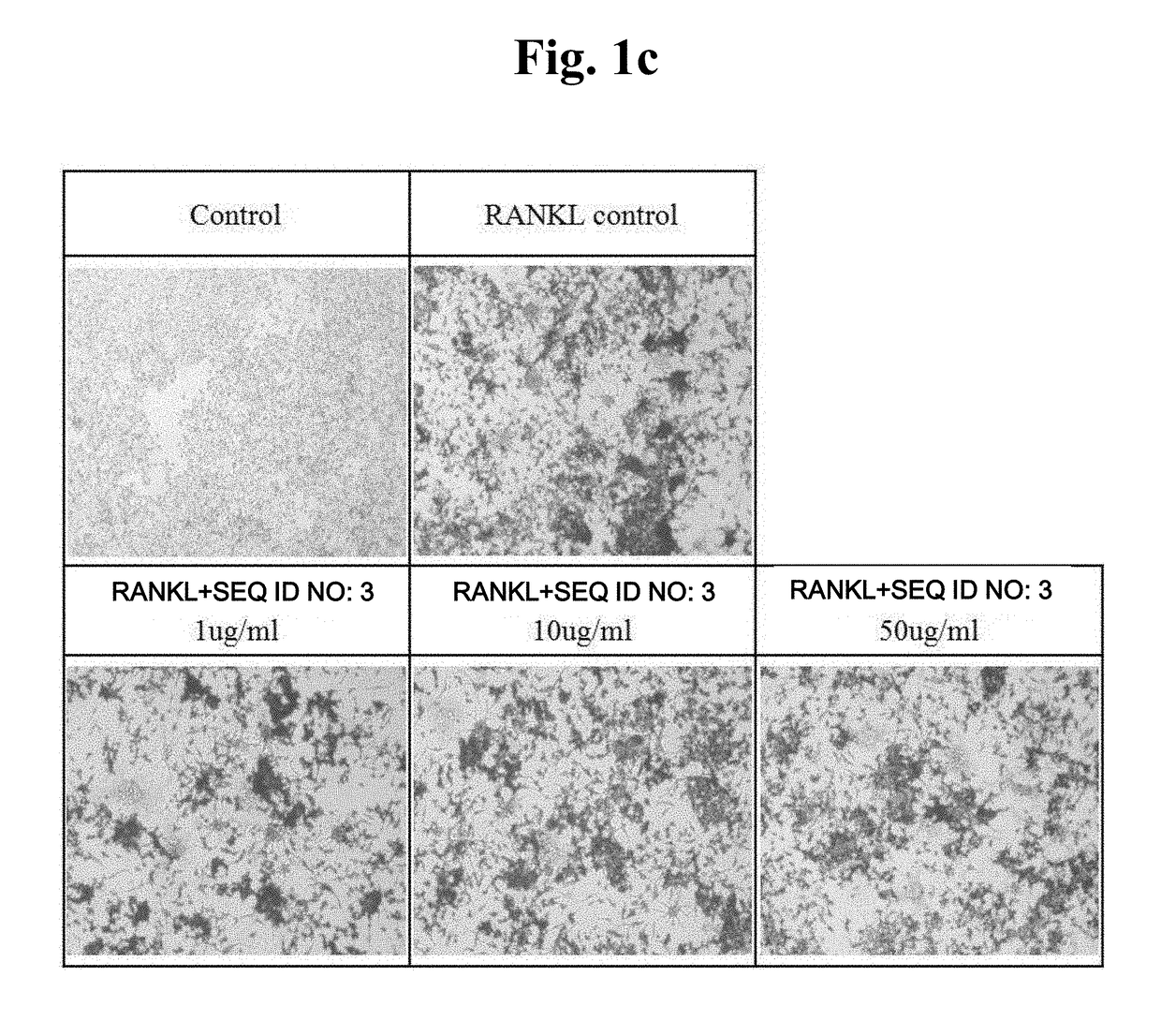 Peptide having osteoclast differentiation and activation inhibition, and use of same