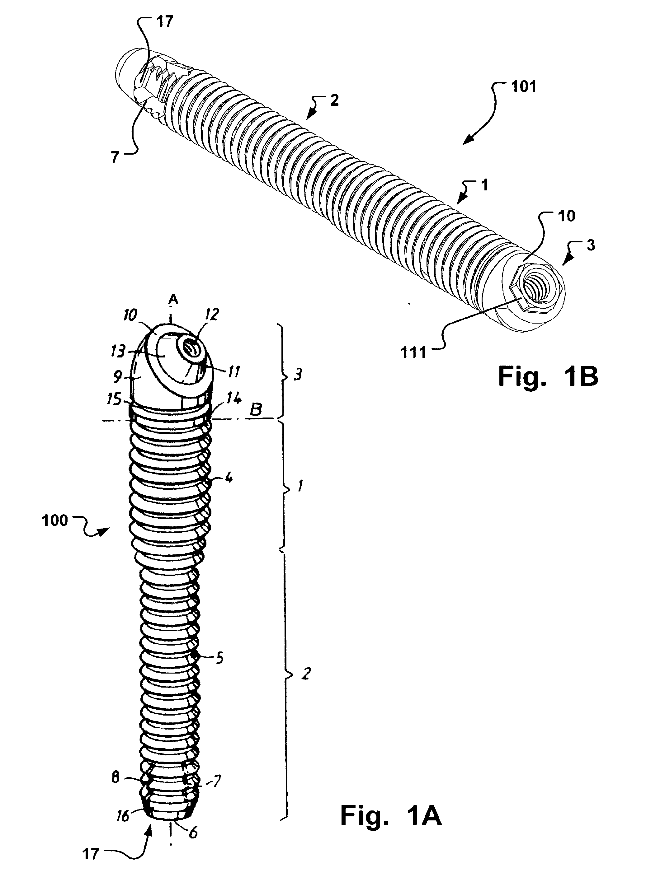 Medical implant and method of implantation