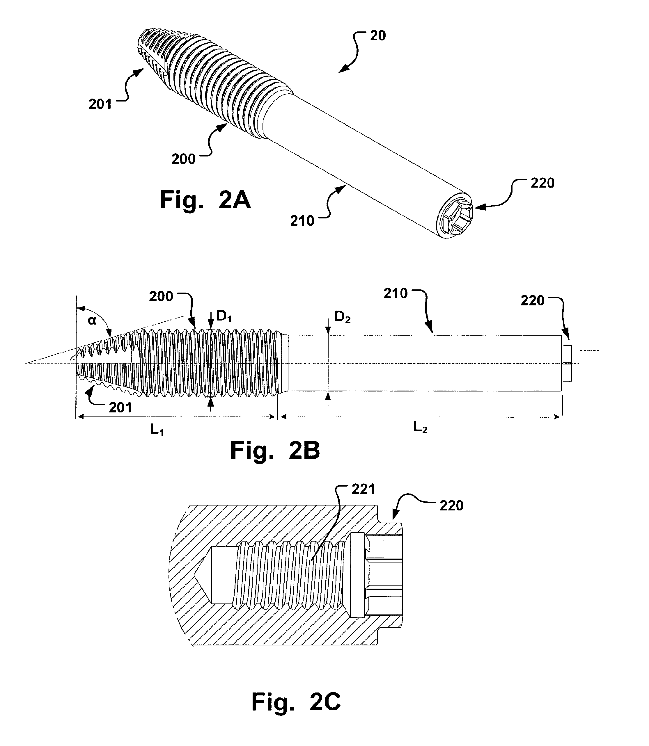 Medical implant and method of implantation