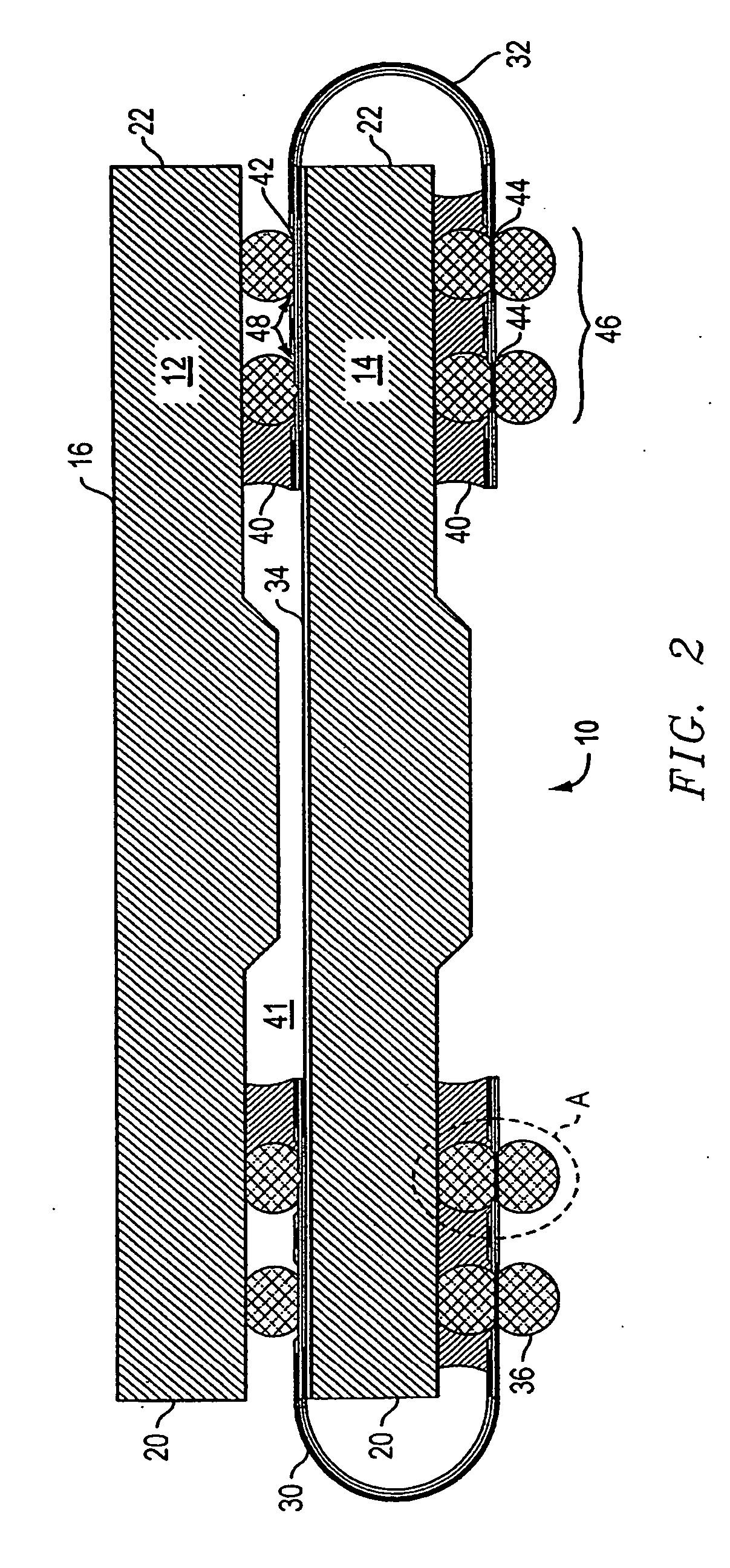 Stacking system and method
