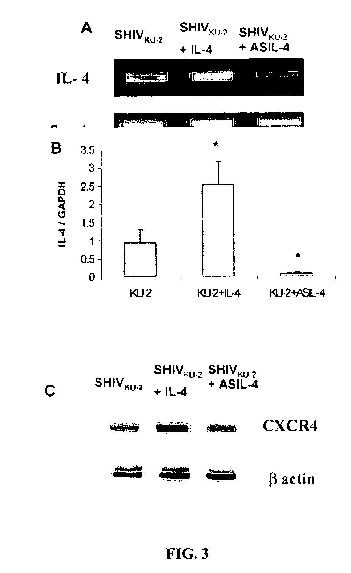 Inhibition of HIV and SHIV replication with antisense interleukin-4