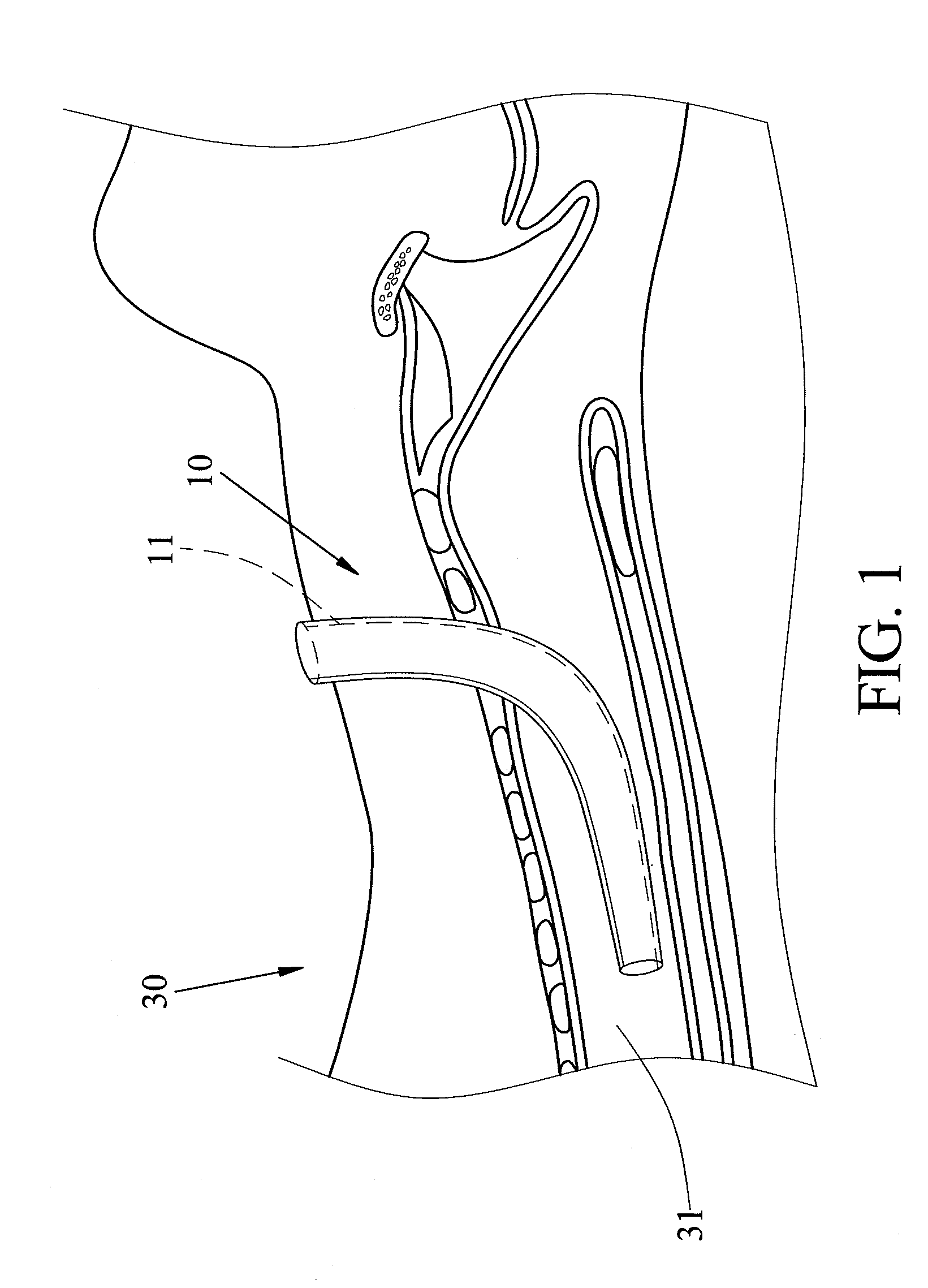 Device for Positioning Tracheostomy Tube