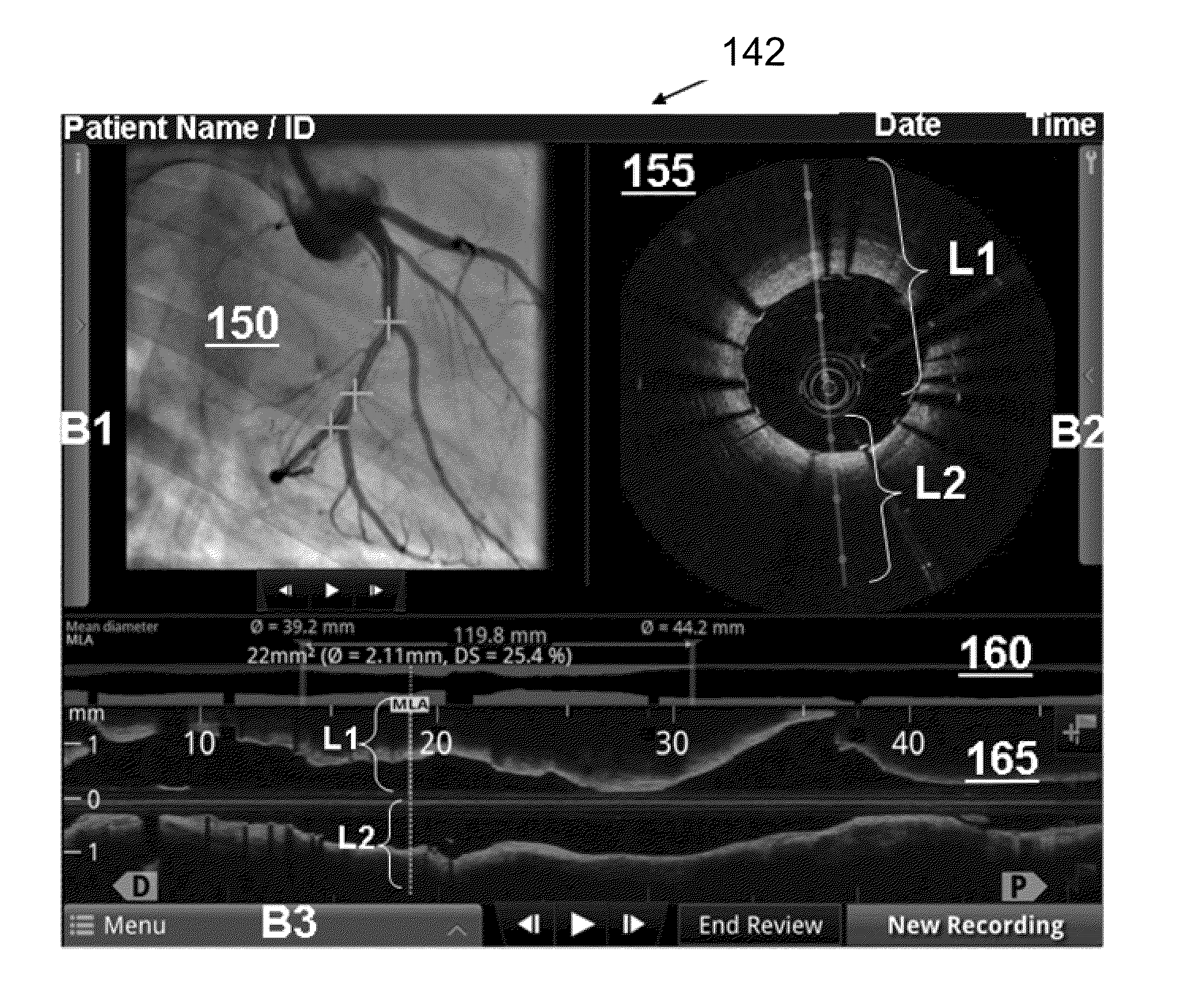 Vascular data processing and image registration systems, methods, and apparatuses