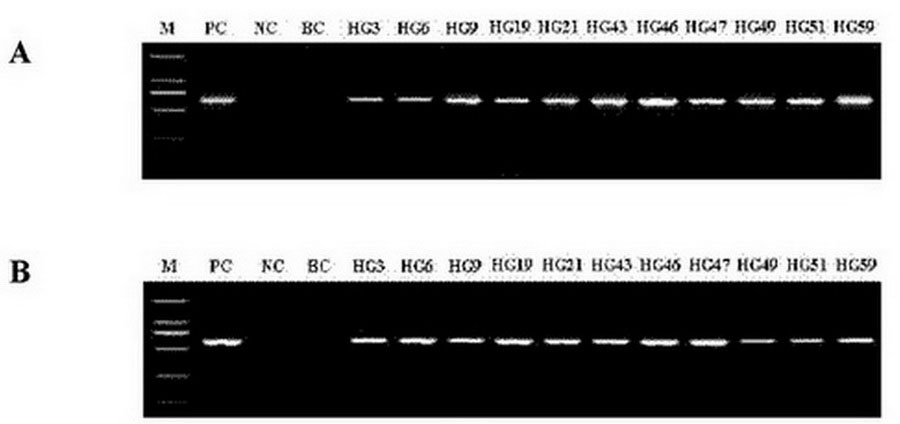 Method for enhancing content of tanshinone in salvia miltiorrhiza hairy root by double-key enzyme genetic transformation
