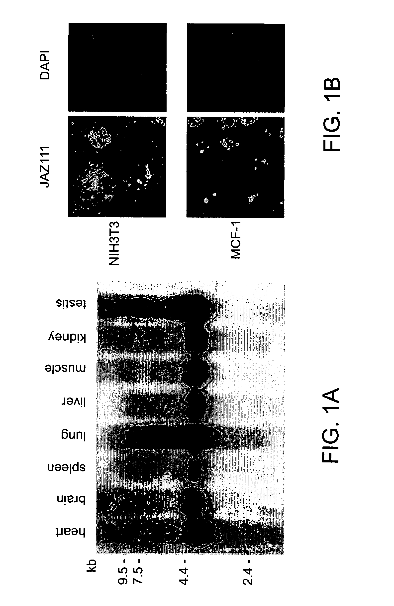 Compositions and methods for the treatment of neoplasia