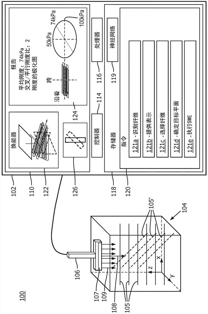 Ultrasound system and methods for smart shear wave elastography