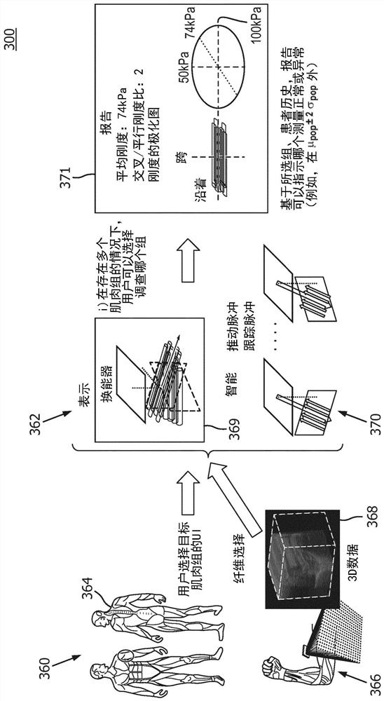 Ultrasound system and methods for smart shear wave elastography