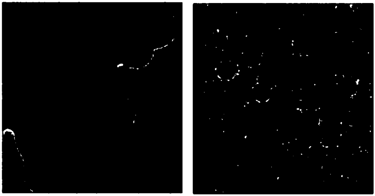 Preparation method and application of nano-selenium-amantadine compound nano-drug carrier