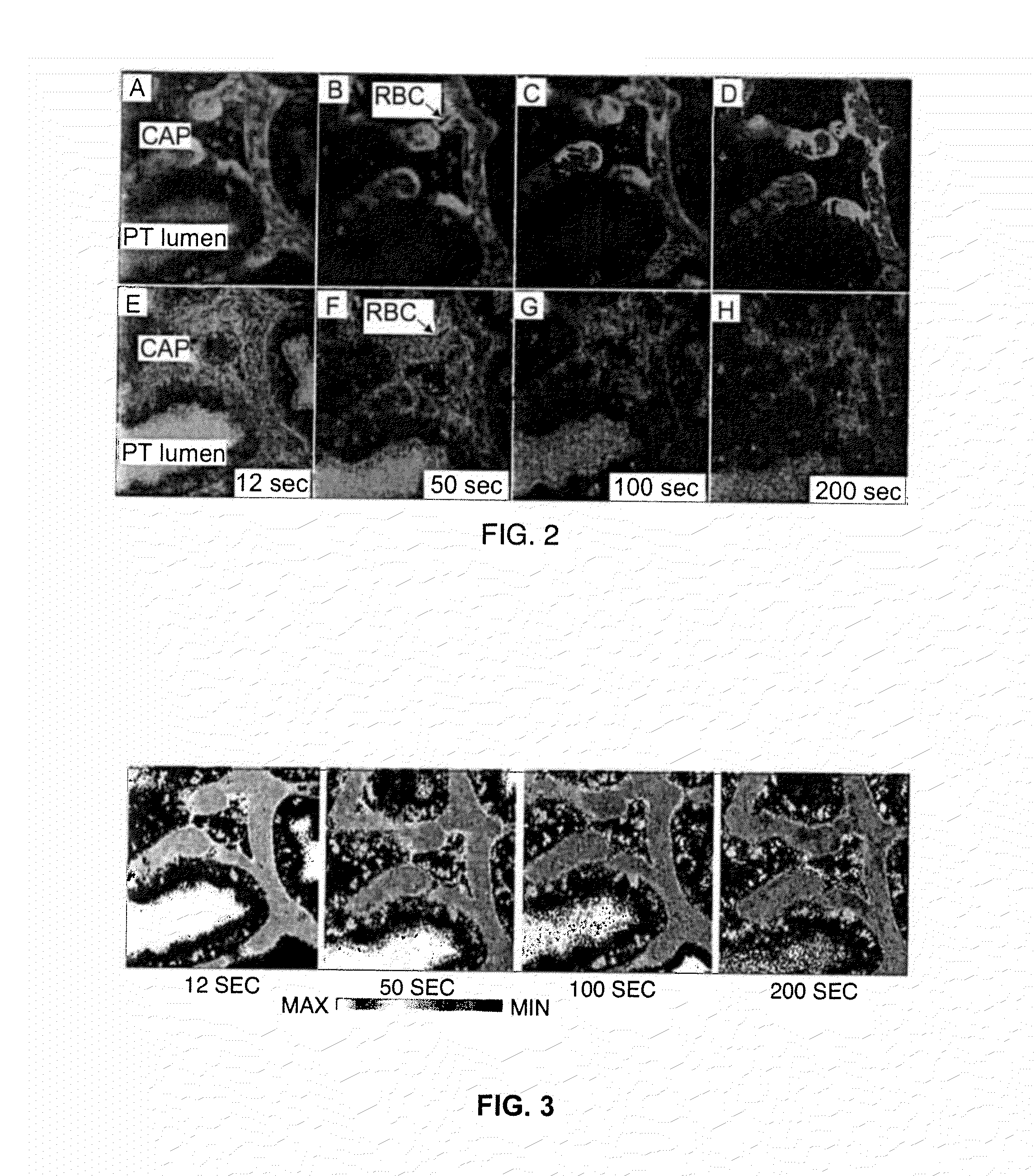 Renal function analysis method and apparatus