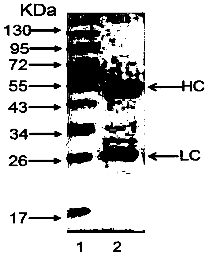 Anti-human CD26 antibody and application of anti-human CD26 antibody in detection kit