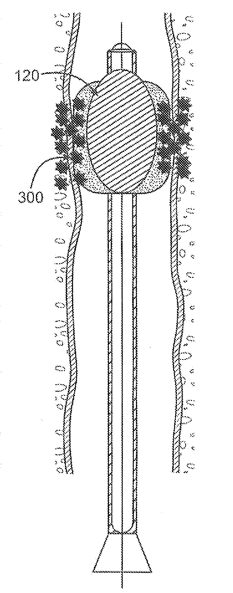 System for delivery of biologically active substances with actuating three dimensional surface