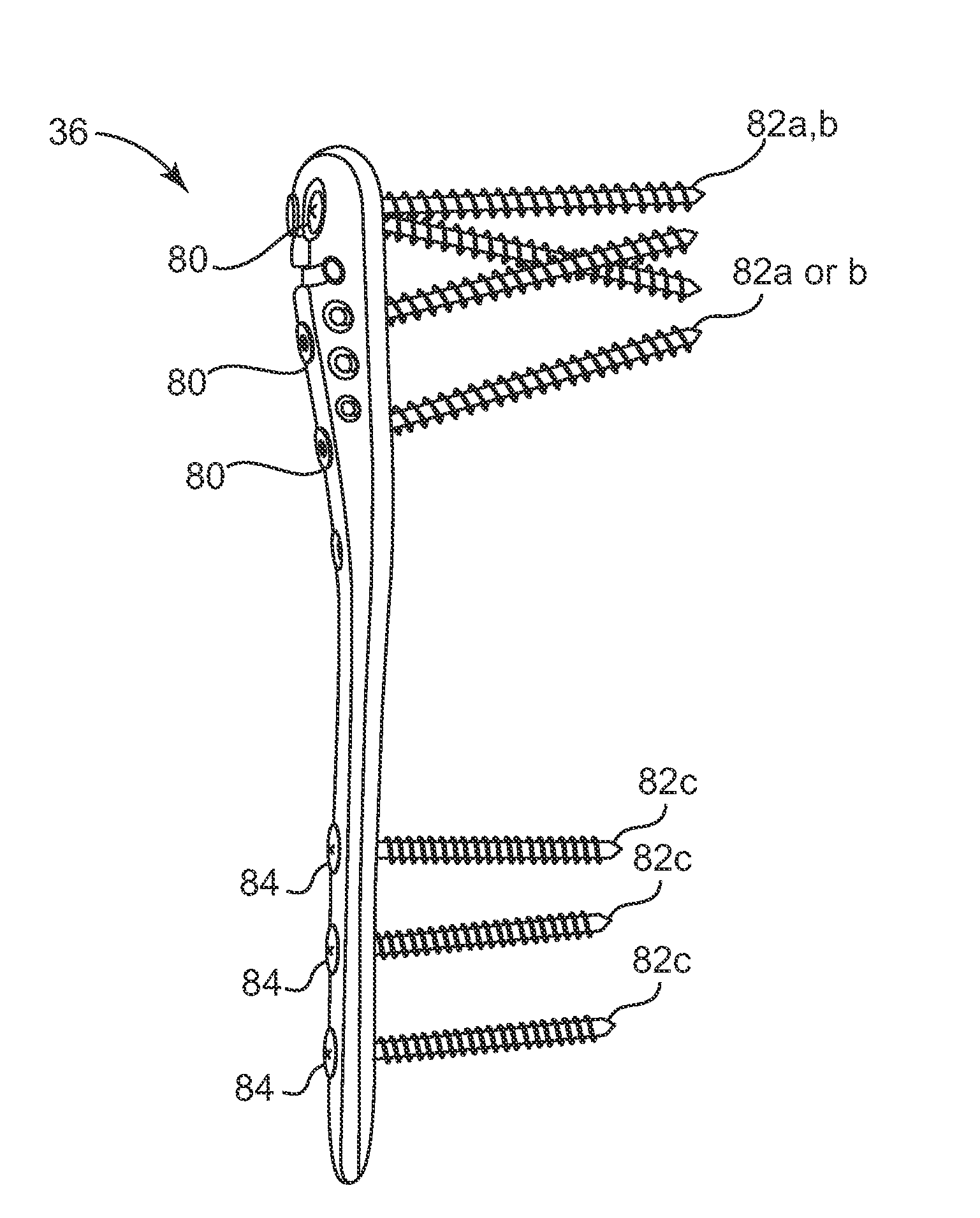 System and method to position and secure fractured bones