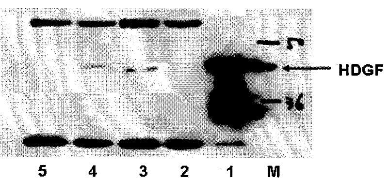 Monoclonal antibody of hepatoma-derived growth factor and use thereof
