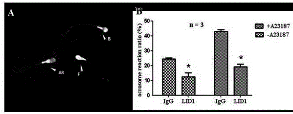 Immunogens used to prepare lrrc52 polyclonal antibodies