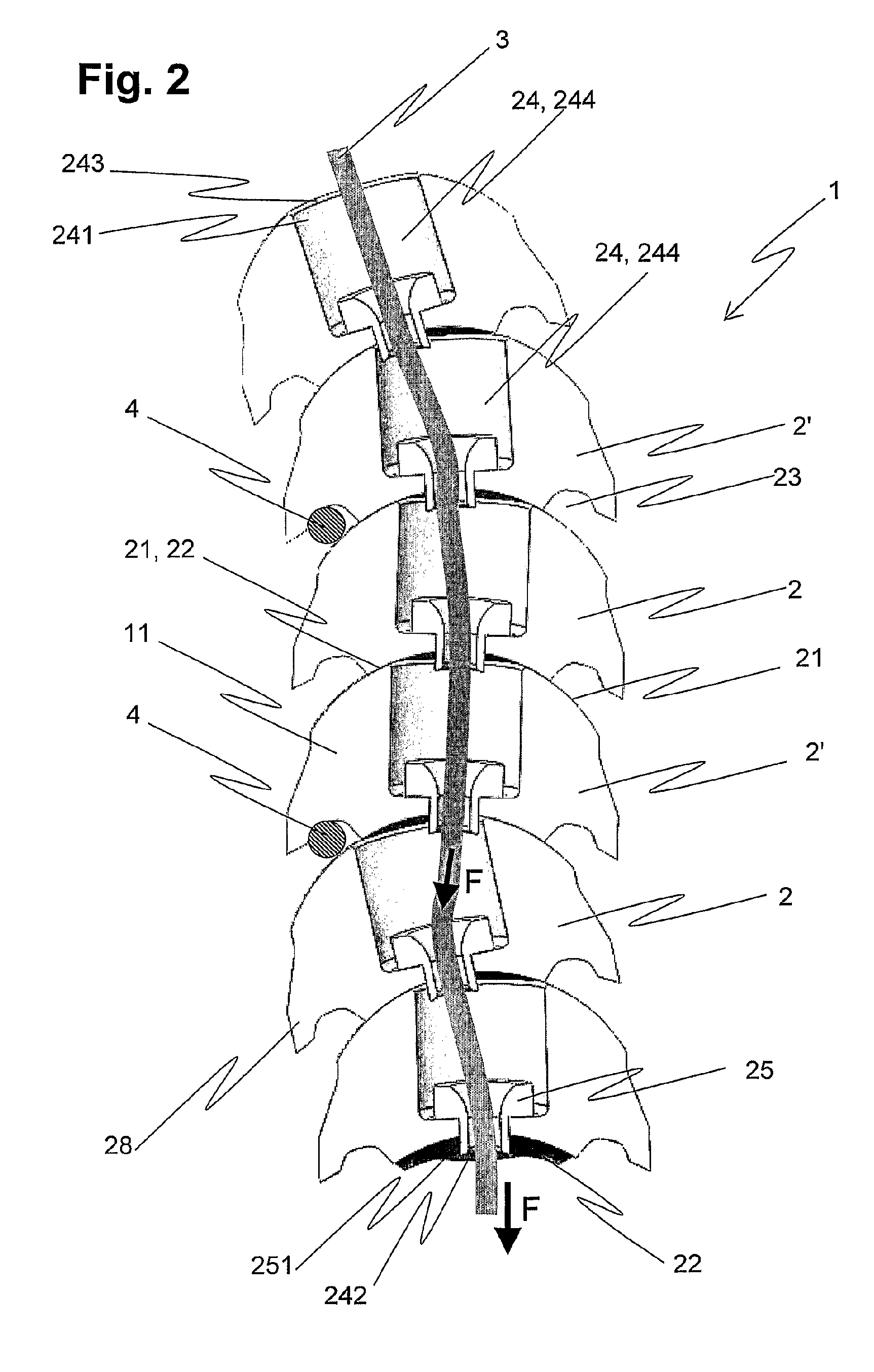 Device for externally fixing bone fractures