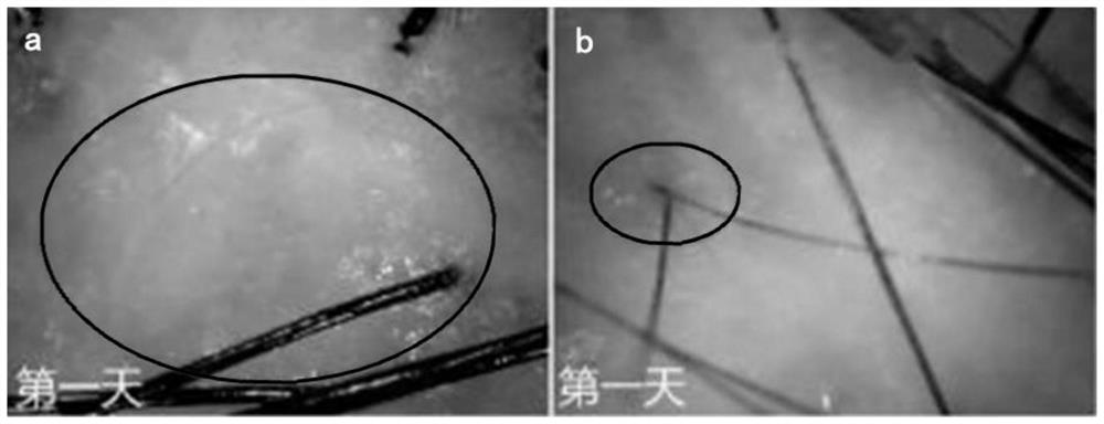 Application of recombinant III-type humanized collagen in scalp care, and scalp care product containing recombinant III-type humanized collagen