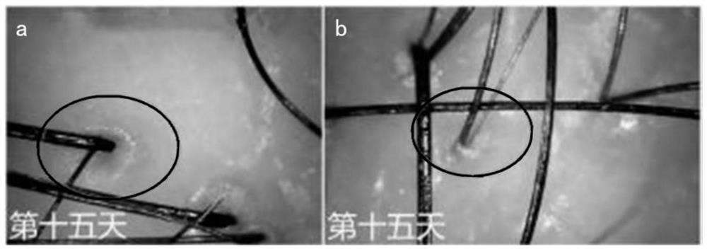 Application of recombinant III-type humanized collagen in scalp care, and scalp care product containing recombinant III-type humanized collagen