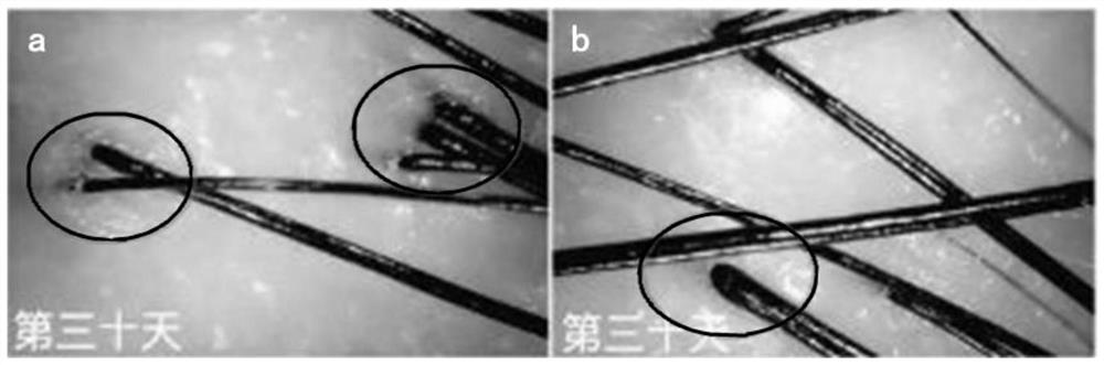 Application of recombinant III-type humanized collagen in scalp care, and scalp care product containing recombinant III-type humanized collagen