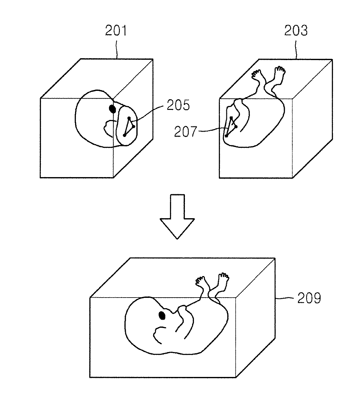 3D ultrasound system for extending view of image and method for operating the 3D ultrasound system