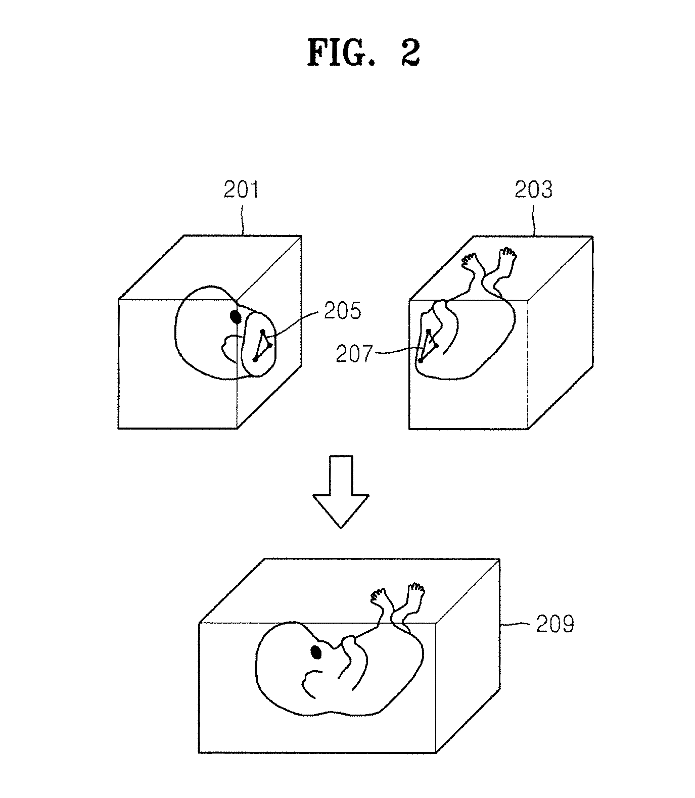 3D ultrasound system for extending view of image and method for operating the 3D ultrasound system