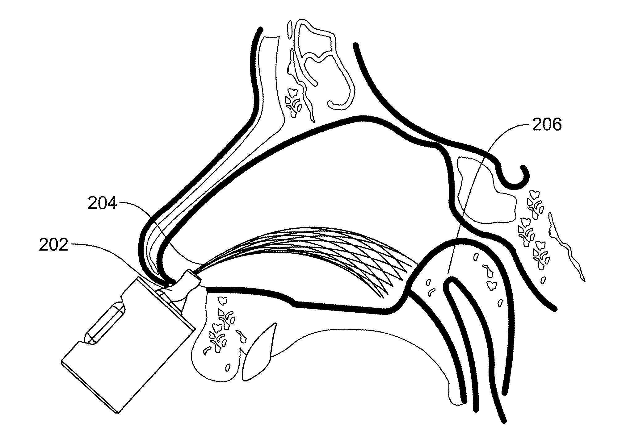 Nasal Delivery Device and Methods of Use