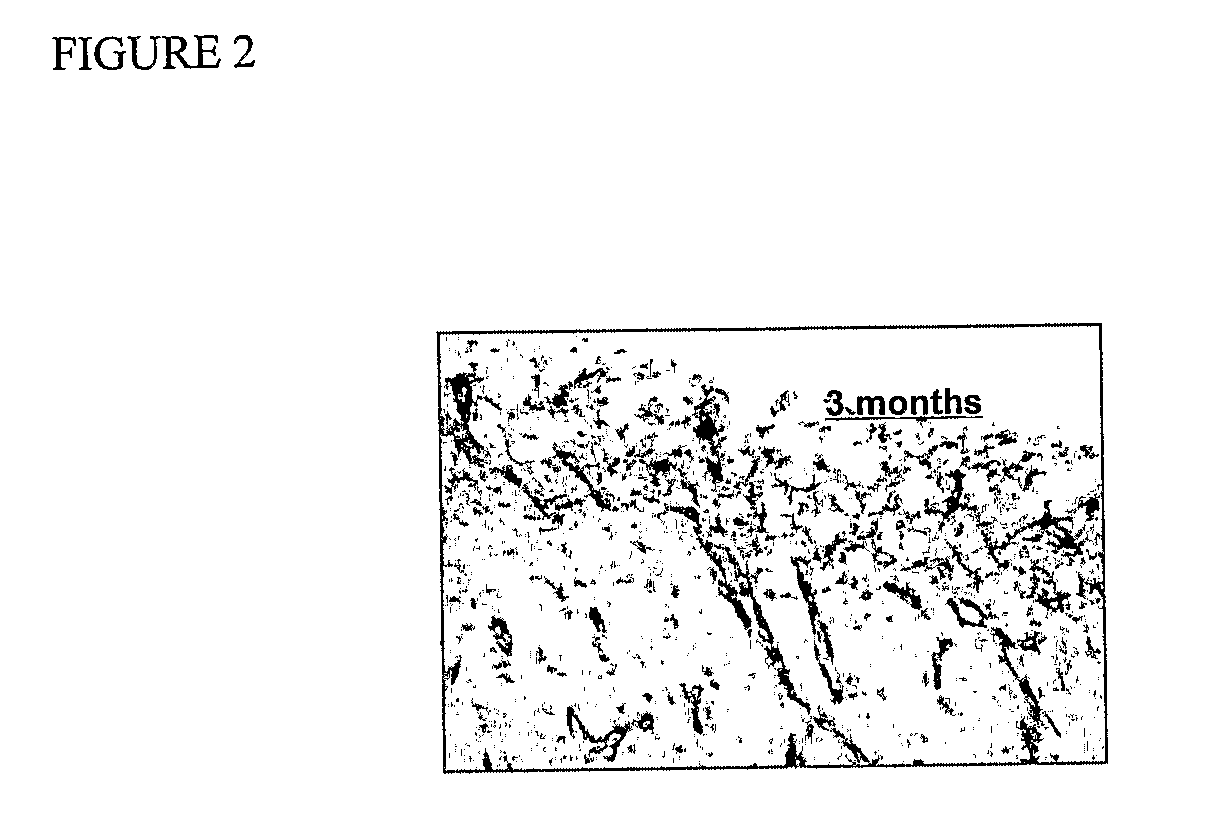 Methods, Compositions and Devices For Promoting Anglogenesis