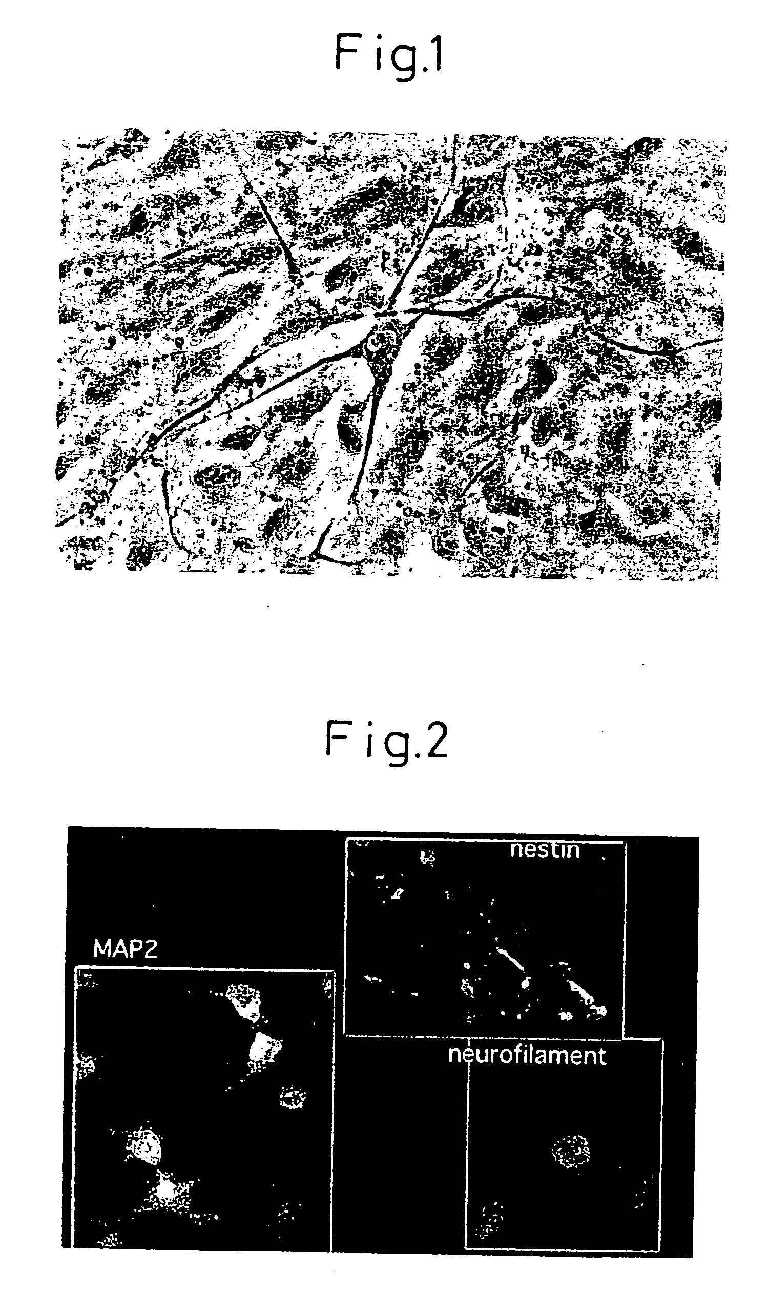 Method of inducing differentiation of bone marrow stromal cells to neural cells or skeletal muscle cells by introduction of notch gene