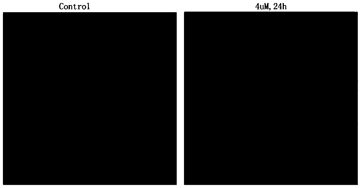 Application of 3β-Hydroxydesmegamusthreamide 3-o-β-d-glucopyranoside in the preparation of antitumor drug preparations