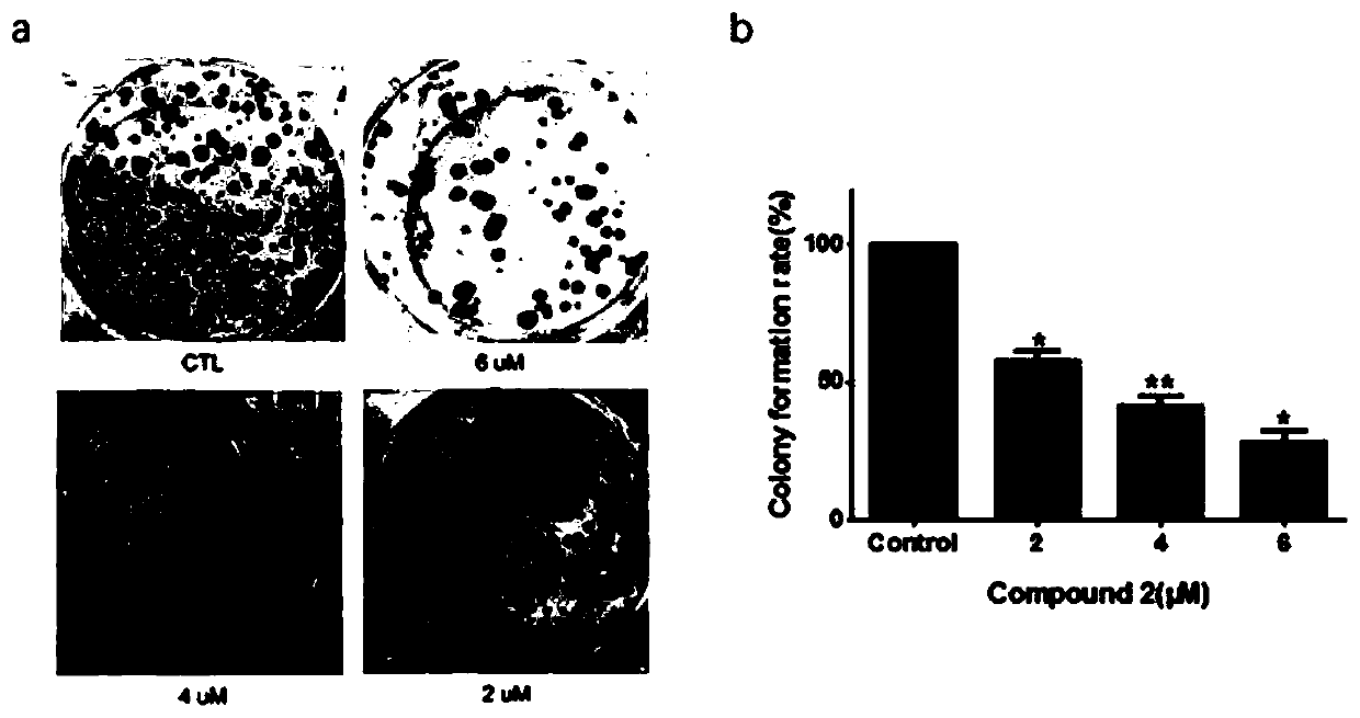 Application of 3β-Hydroxydesmegamusthreamide 3-o-β-d-glucopyranoside in the preparation of antitumor drug preparations