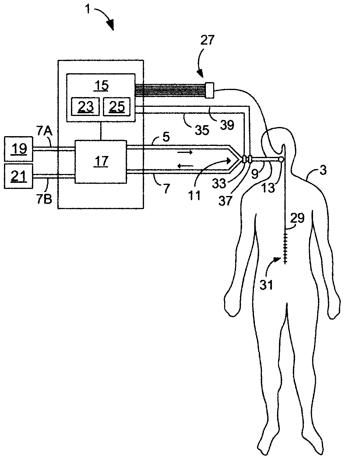 Bioelectrically controlled ventilation mode