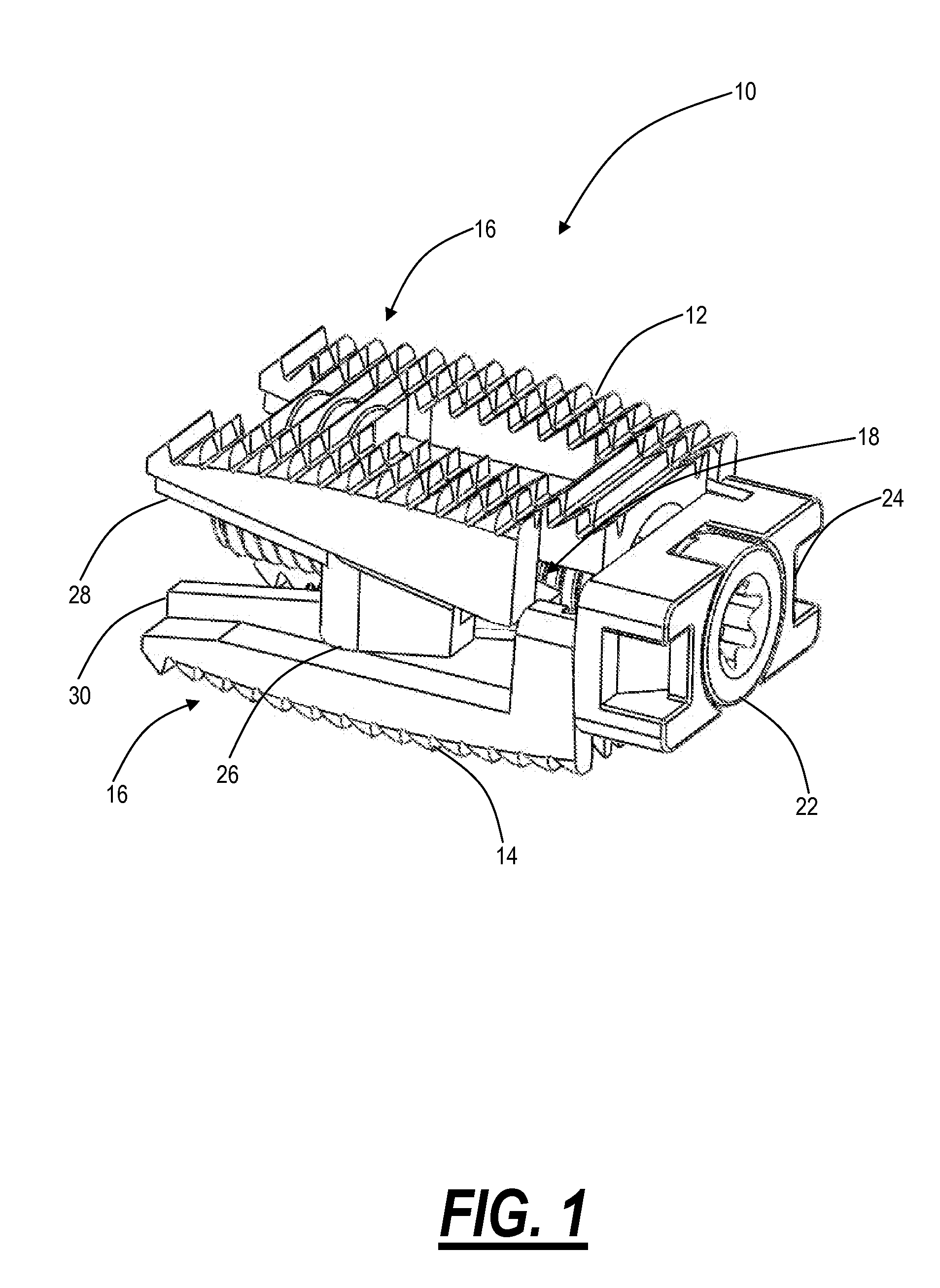 Expandable intervertebral implant and associated surgical method