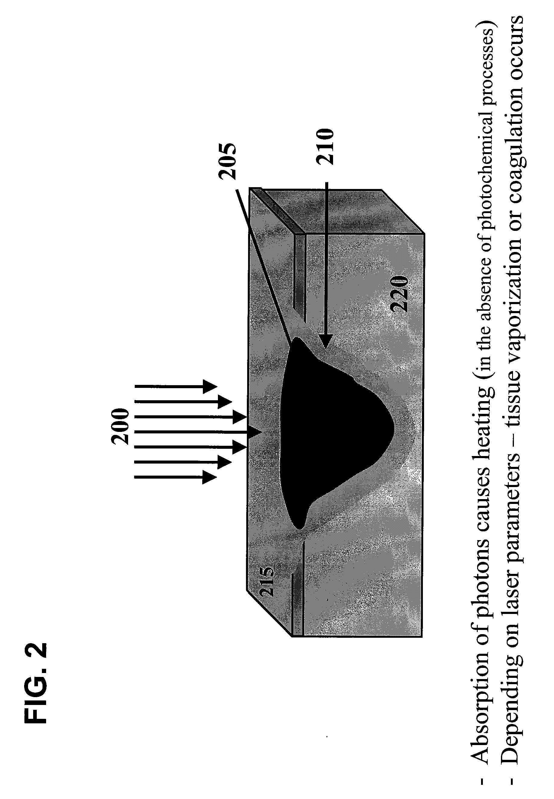 System and method for providing cell specific laser therapy of atherosclerotic plaques by targeting light absorbers in macrophages