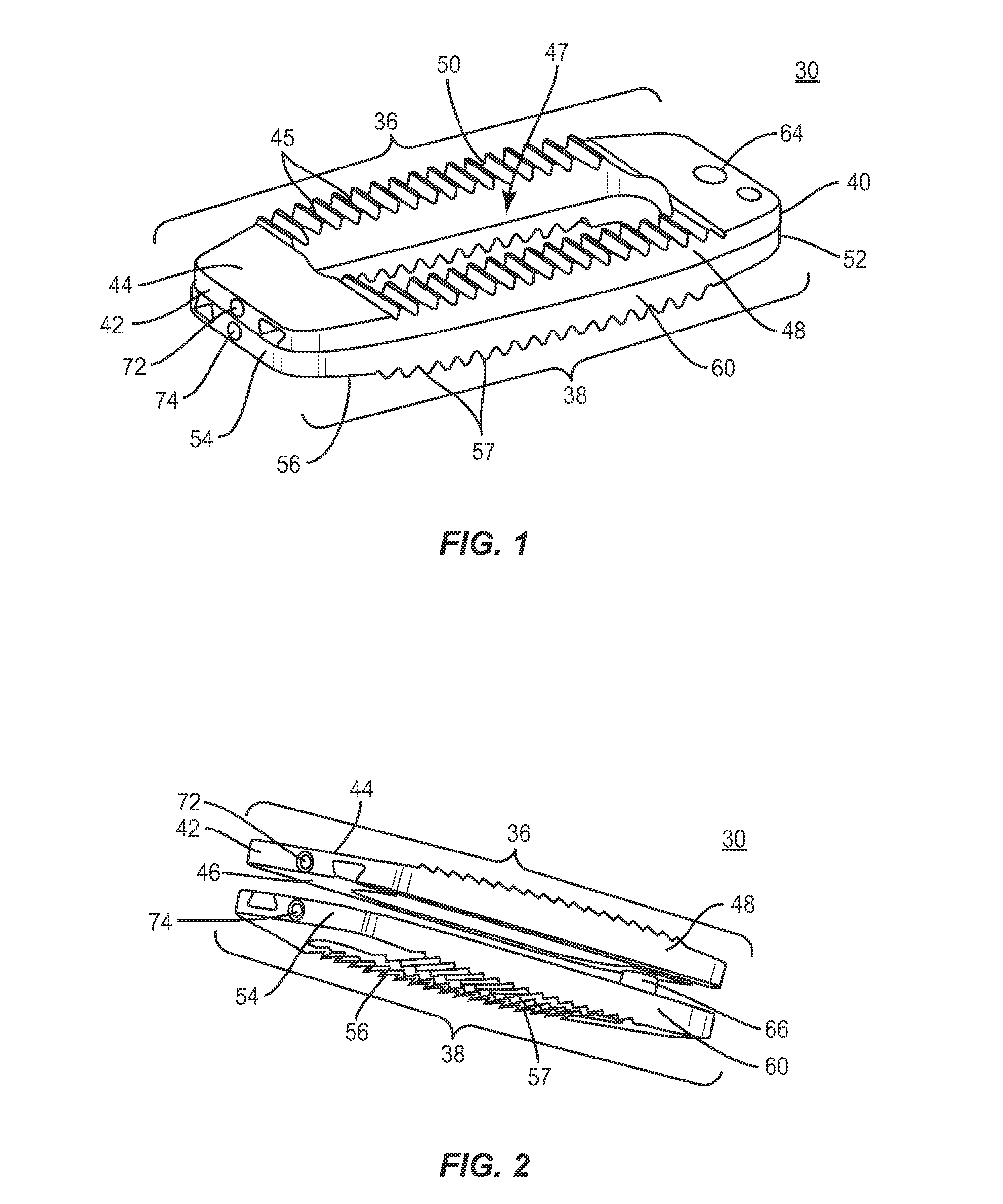 Interbody implant system and methods of use