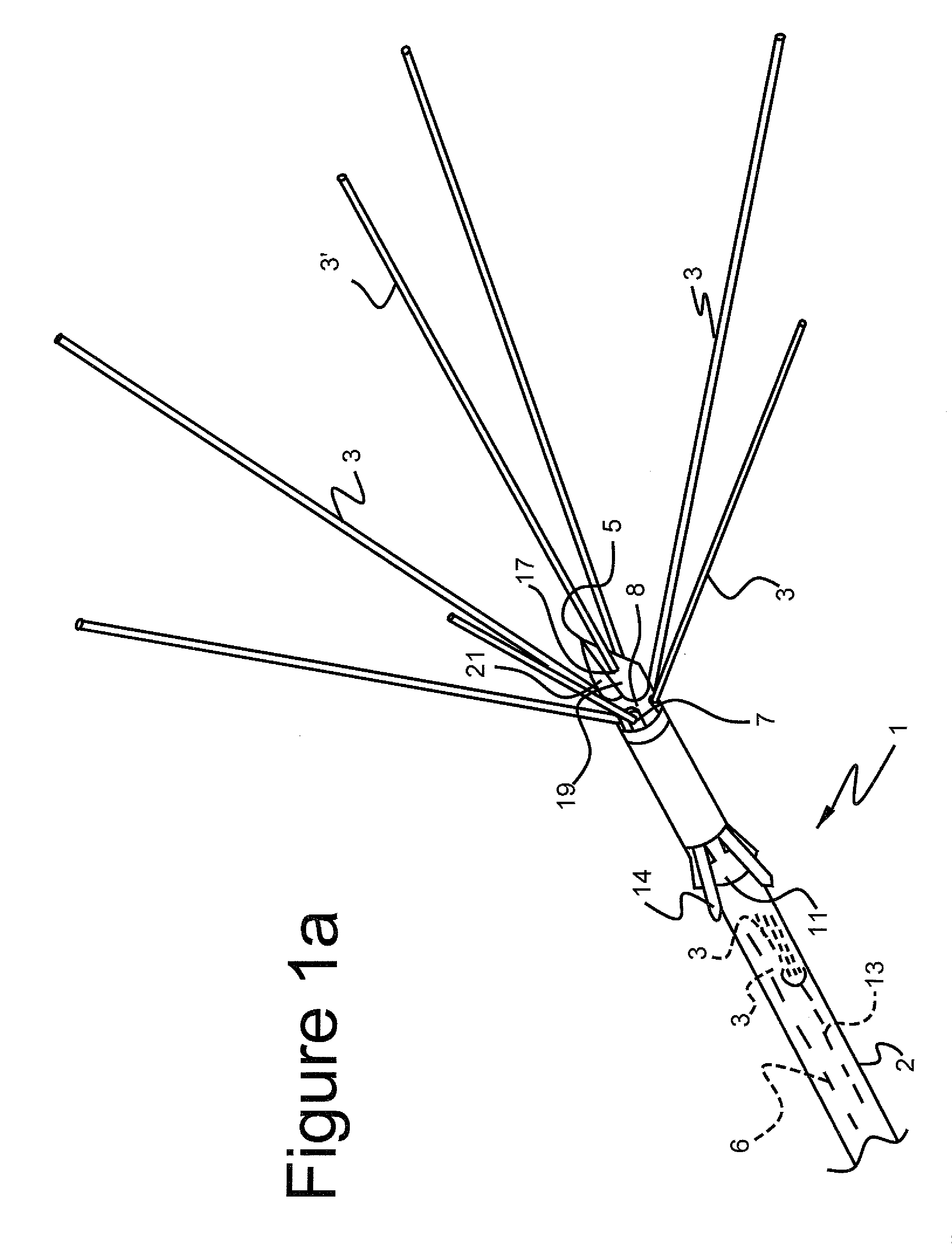 Ablation method