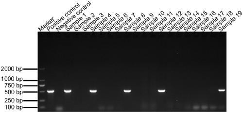 A method for detecting bacterial leaf spot of areca catechu