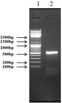Toona sinensis endophytic fungus 56-50 and its secondary metabolites, preparation method and application