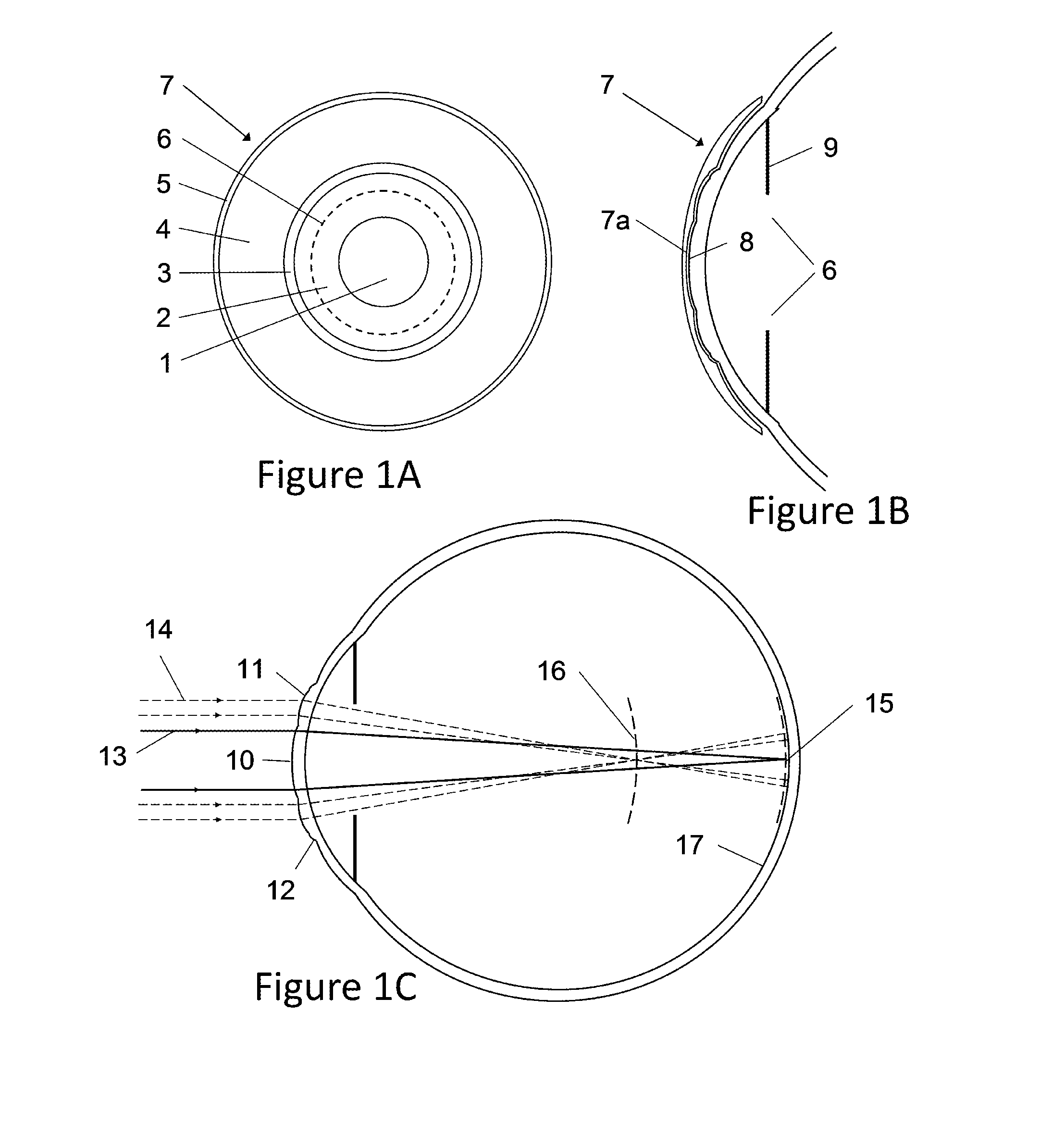 Contact lens and method for prevention of myopia progression