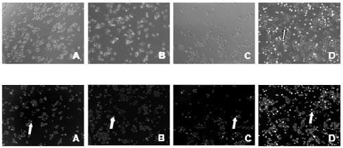 A kind of amphiphilic sericin polymer and its preparation method and application