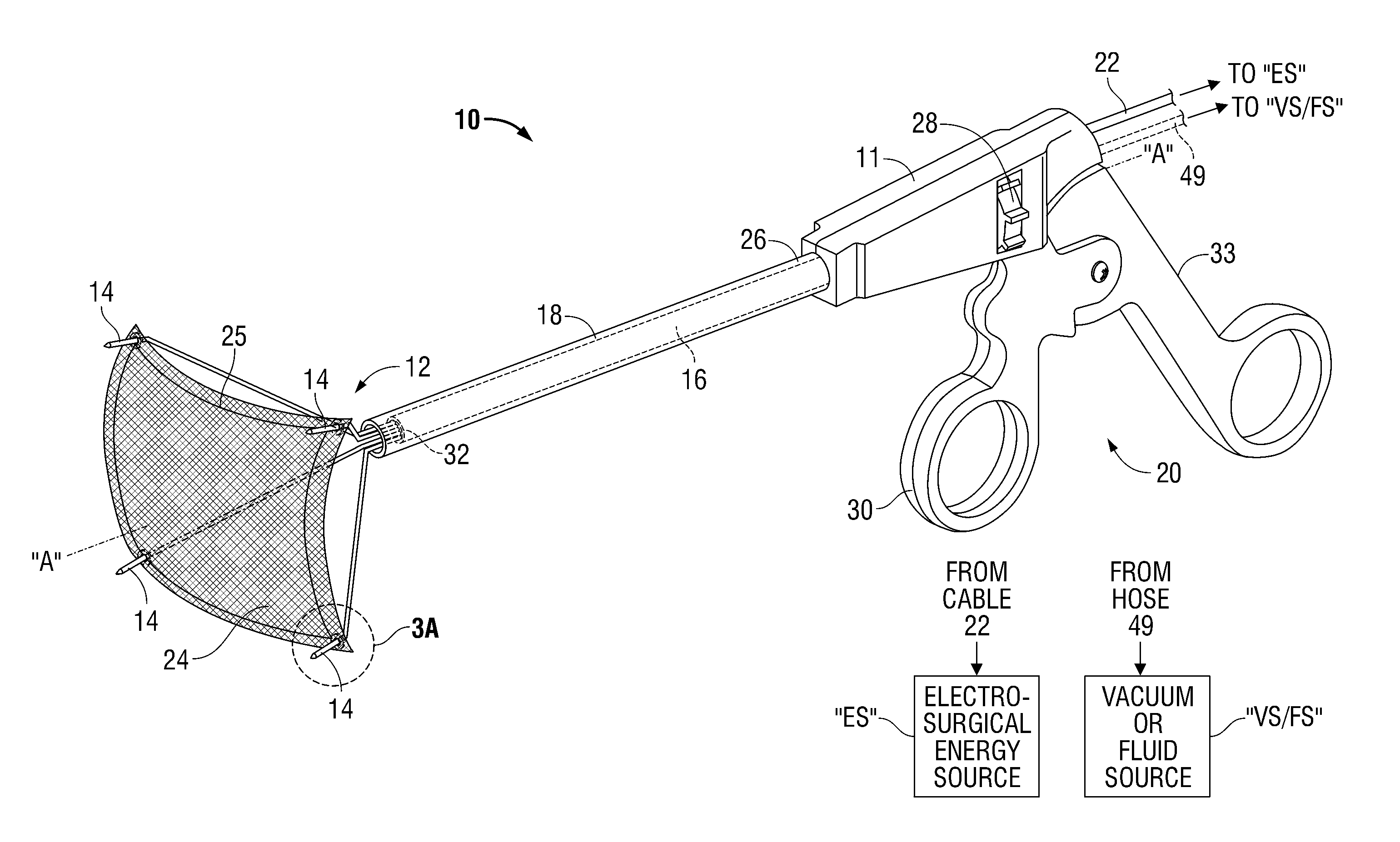 Radio frequency-based surgical implant fixation apparatus