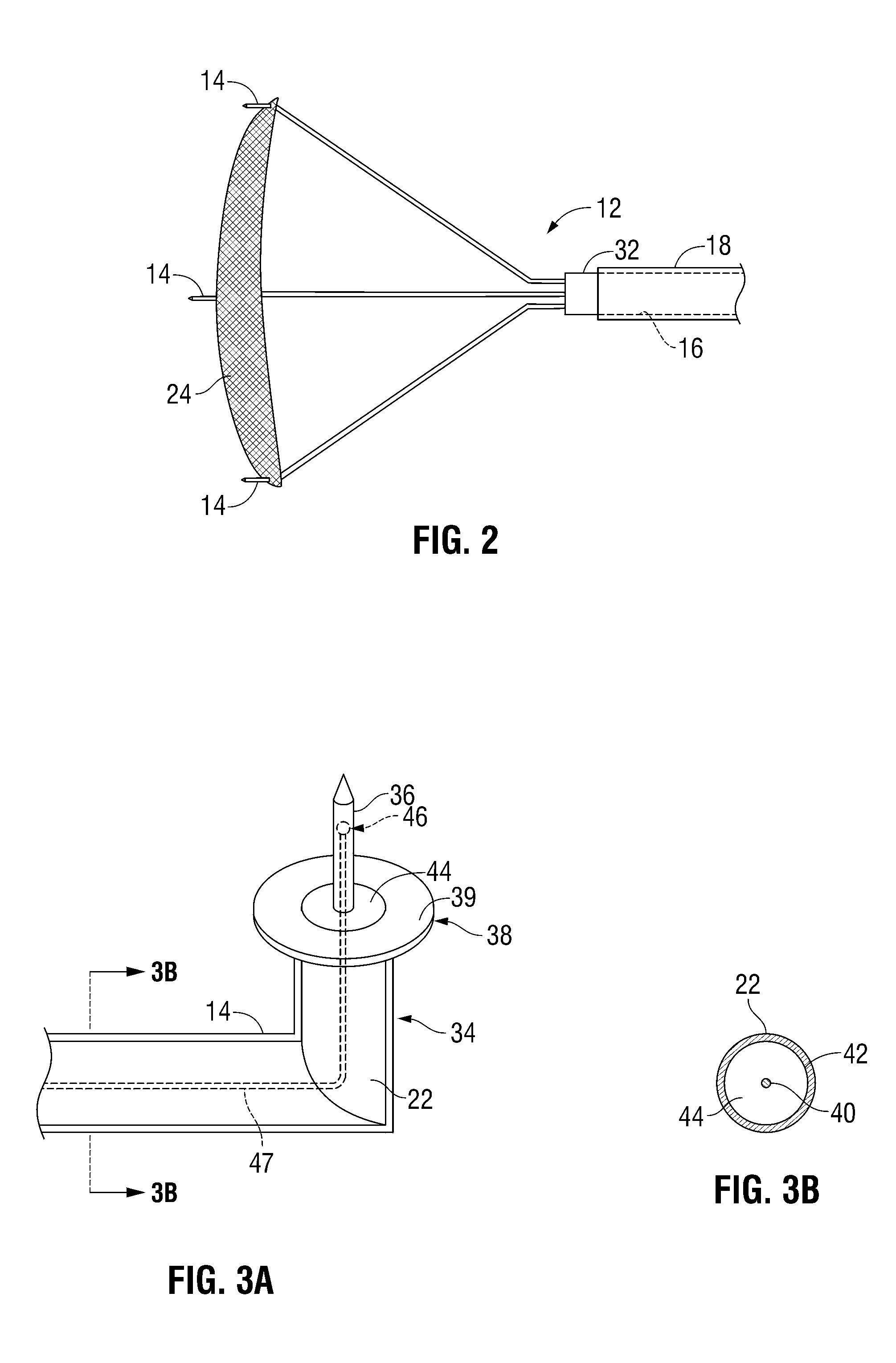 Radio frequency-based surgical implant fixation apparatus