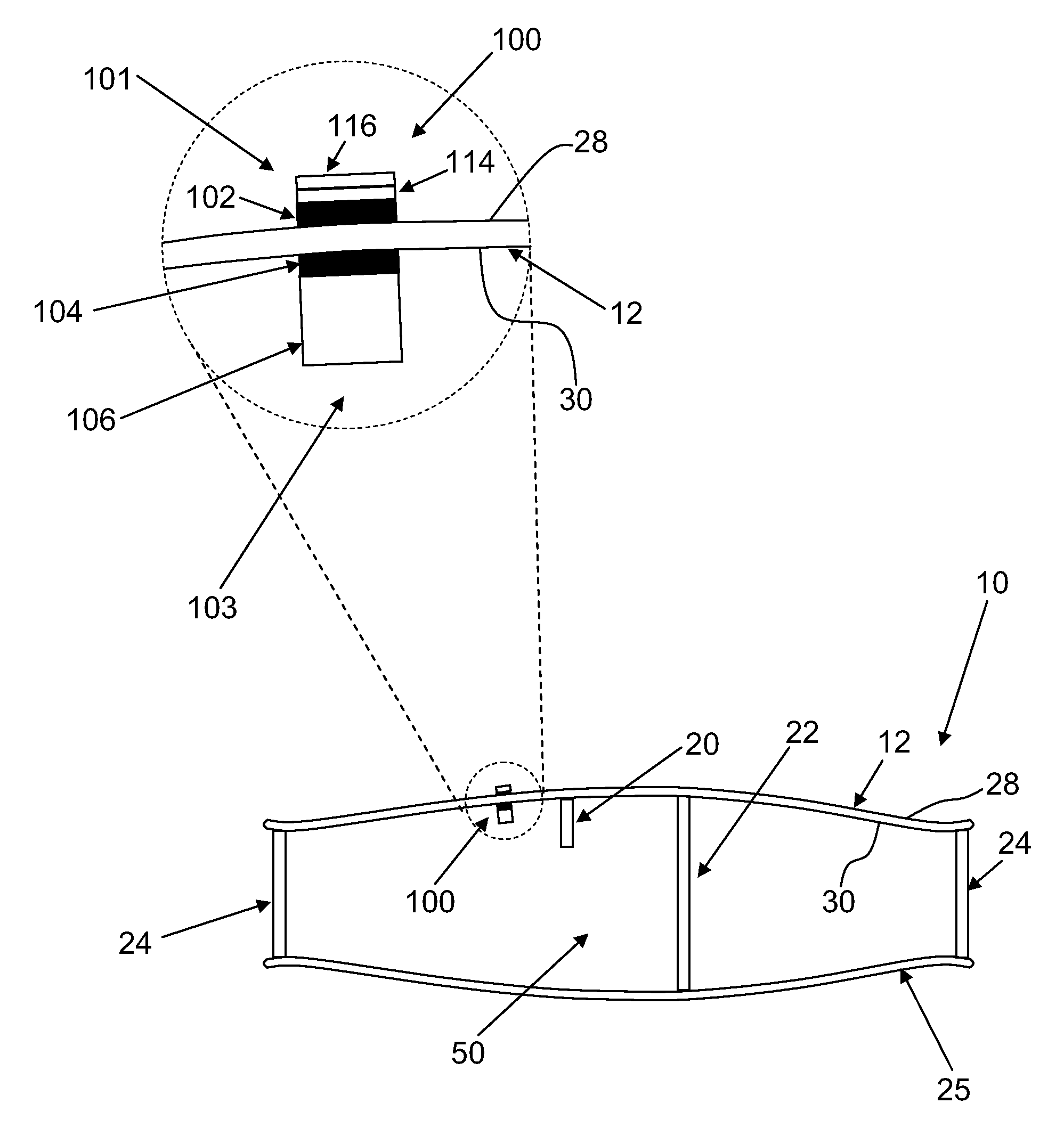 Anti-wolf-note resonator assembly for a string instrument and method of assembling the same