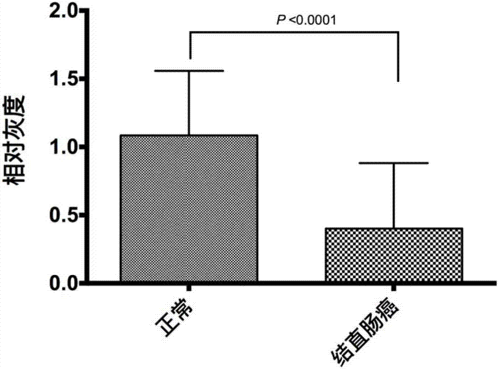 Human colorectal cancer protein mark CLCA1 (calcium-activated chloride channel 1) kit and application thereof