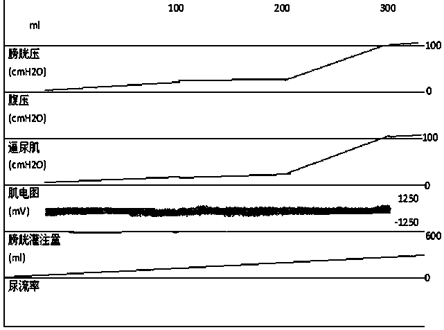 Method for double-cavity bladder clinical pressure measurement by silicon rubber catheter