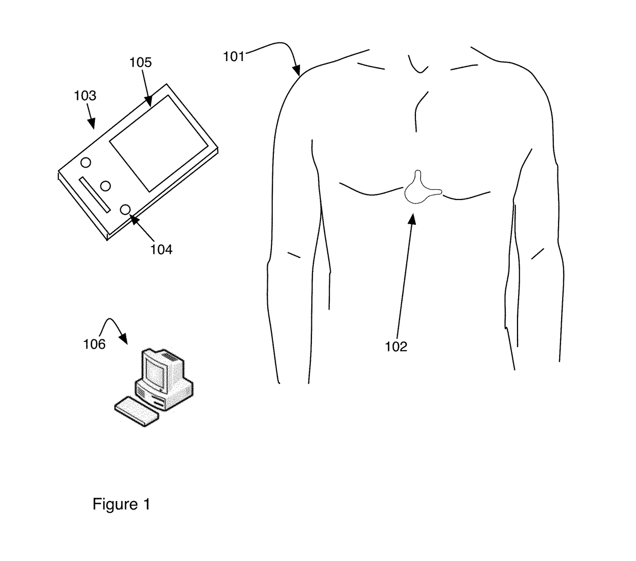 Electrocardiogram Device and Methods
