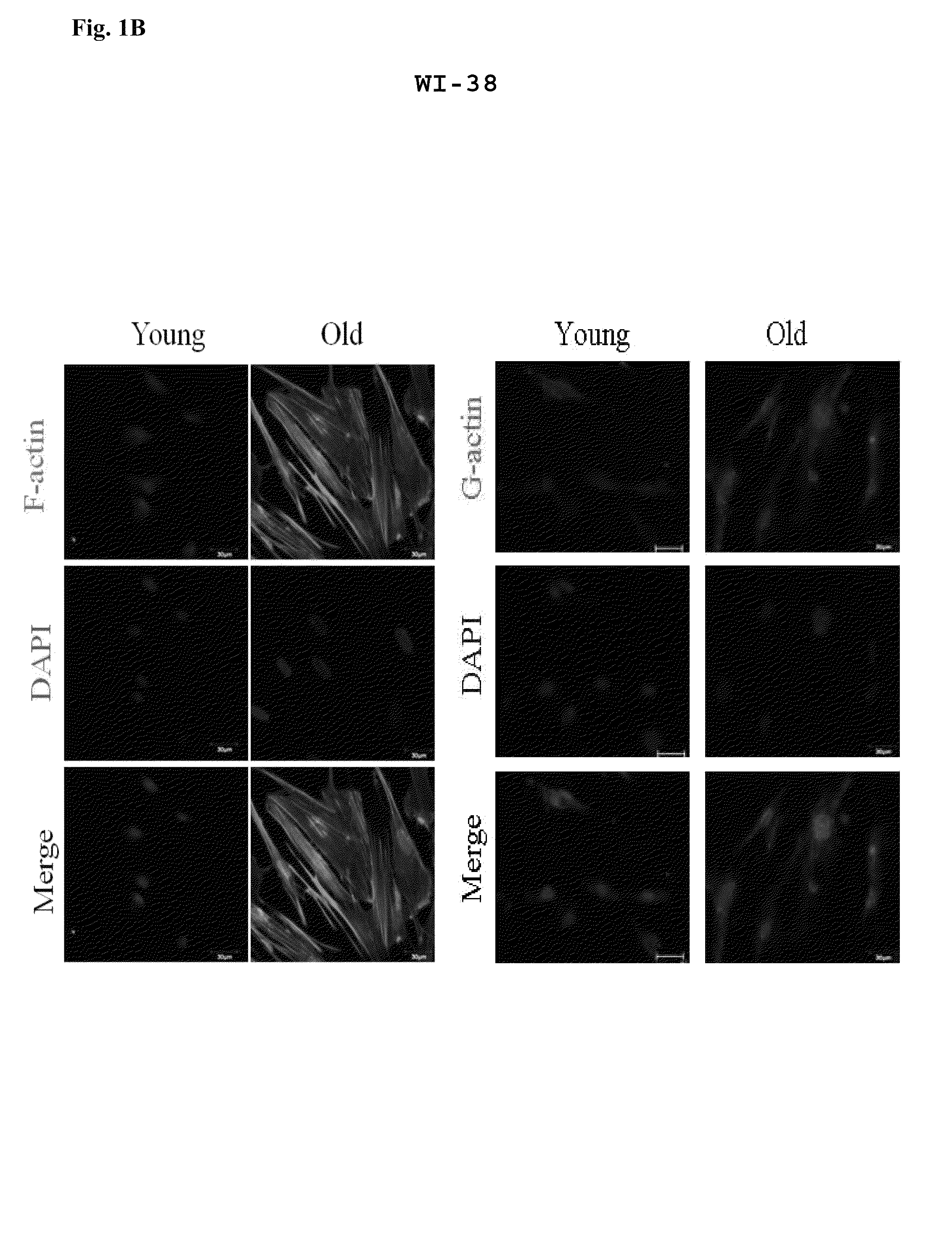 Method for evaluating cell aging by expression level of cofilin