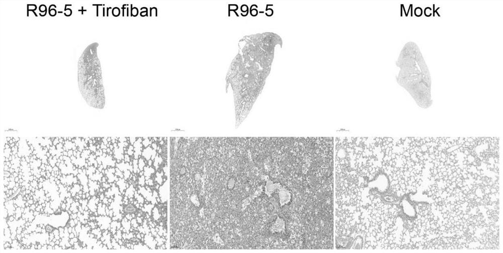 Application of tirofiban in preparation of medicine for treating human respiratory syncytial virus infection