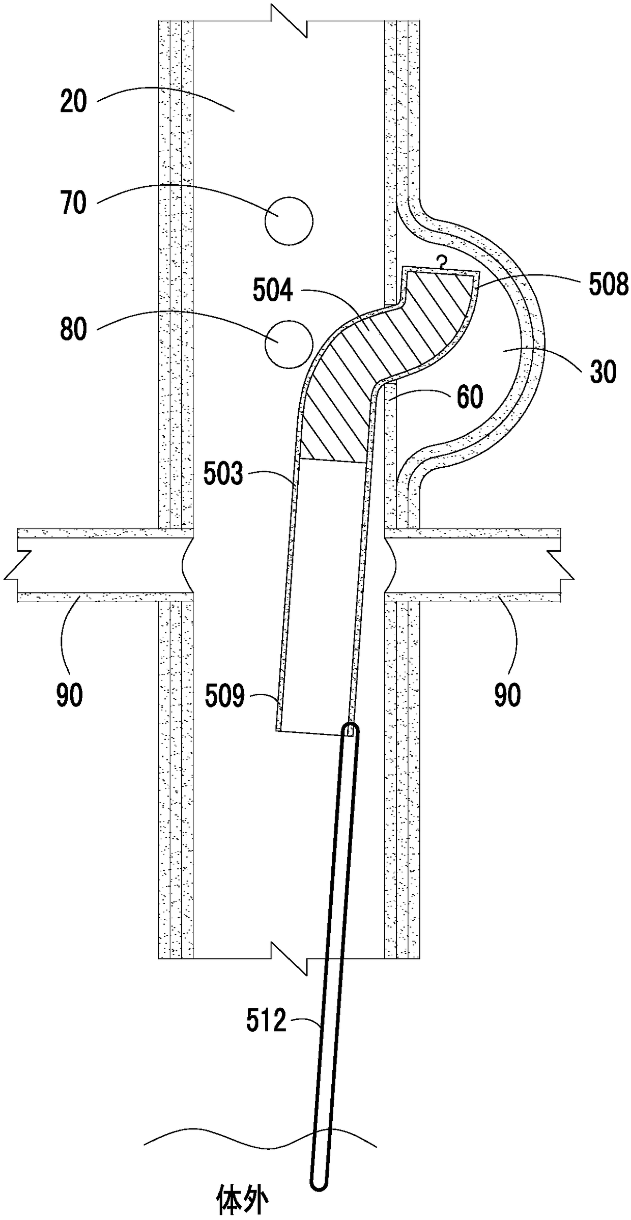 Flexible plugging device and aortic dissection inner membrane breach plugging method