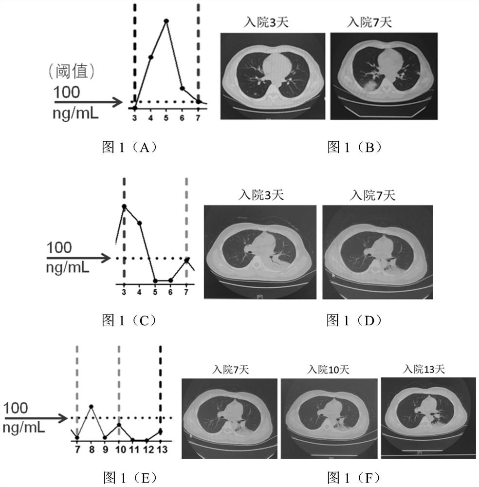 Marker for viral pneumonia and application of marker