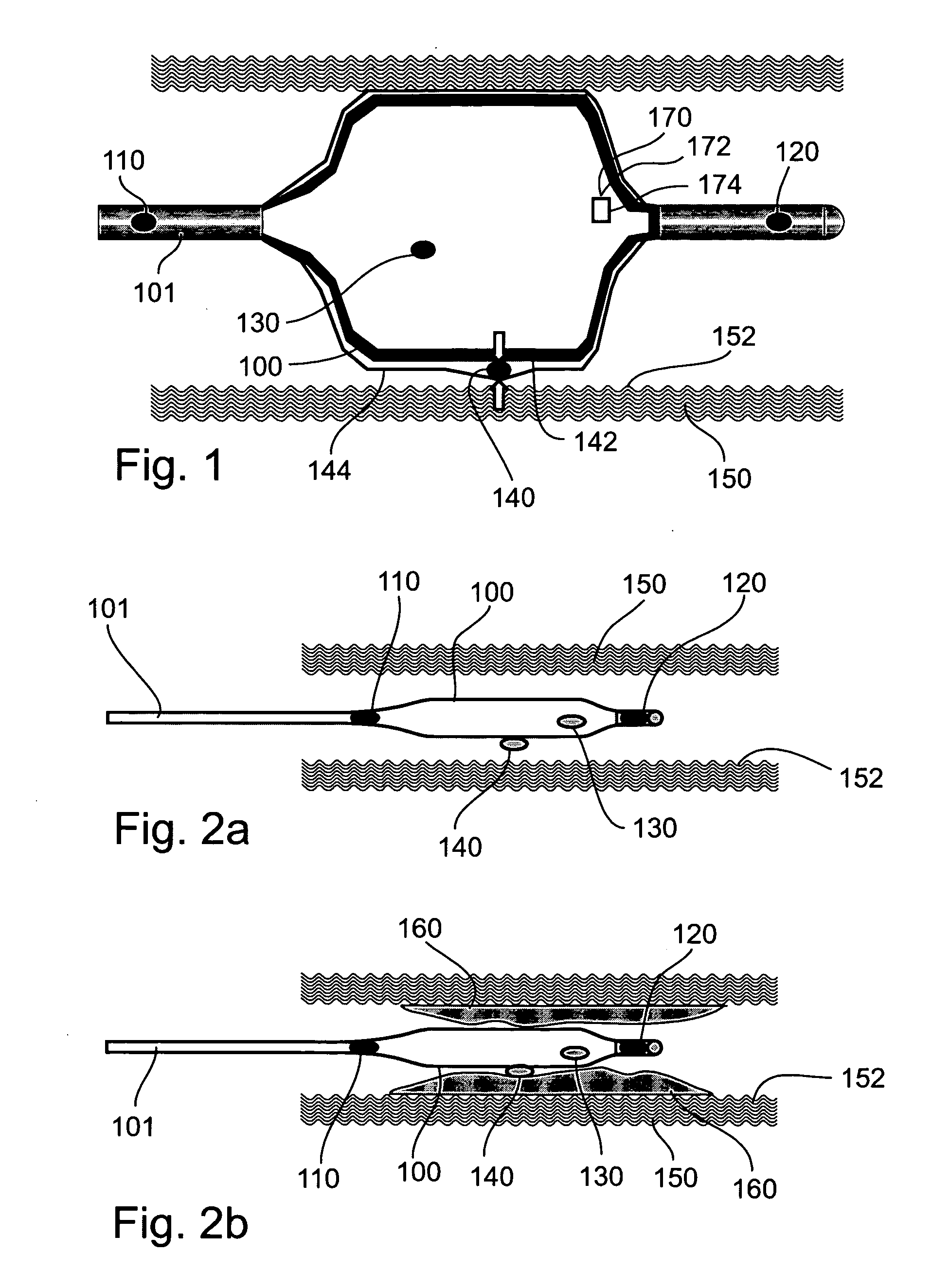 Device, system, and method for detecting, localizing, and characterizing plaque-induced stenosis of a blood vessel